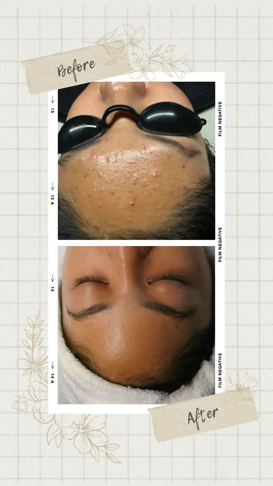 Simply Facials gallery photograph 18