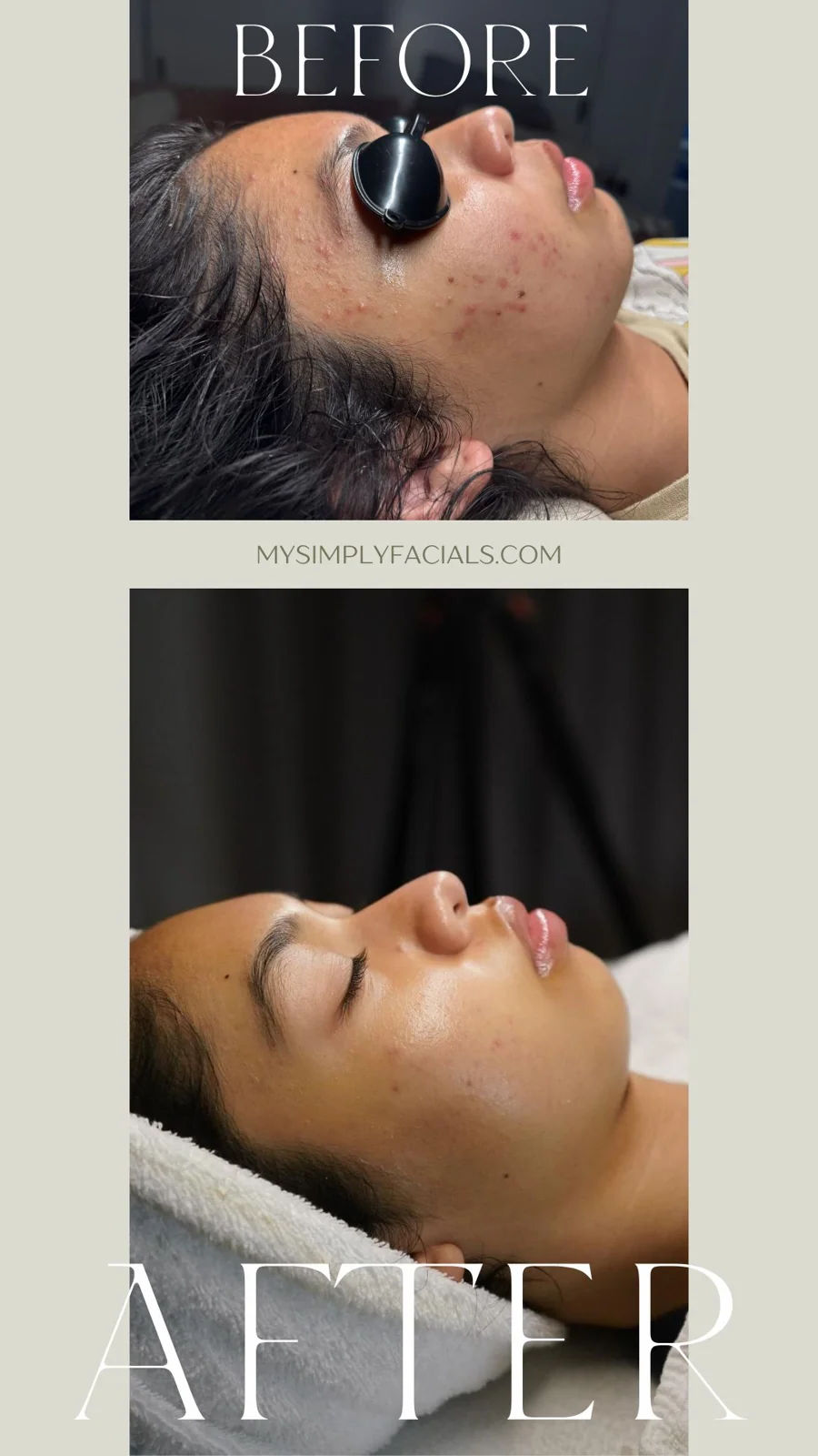 Simply Facials gallery photograph 20