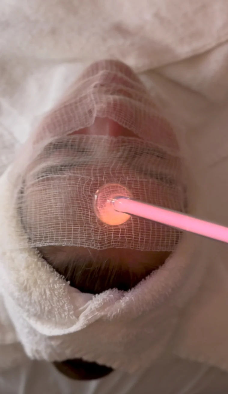 Skincare at Simply Facials