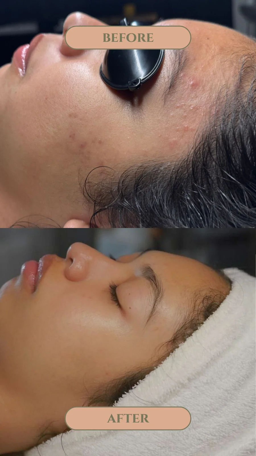 Simply Facials gallery photograph 19